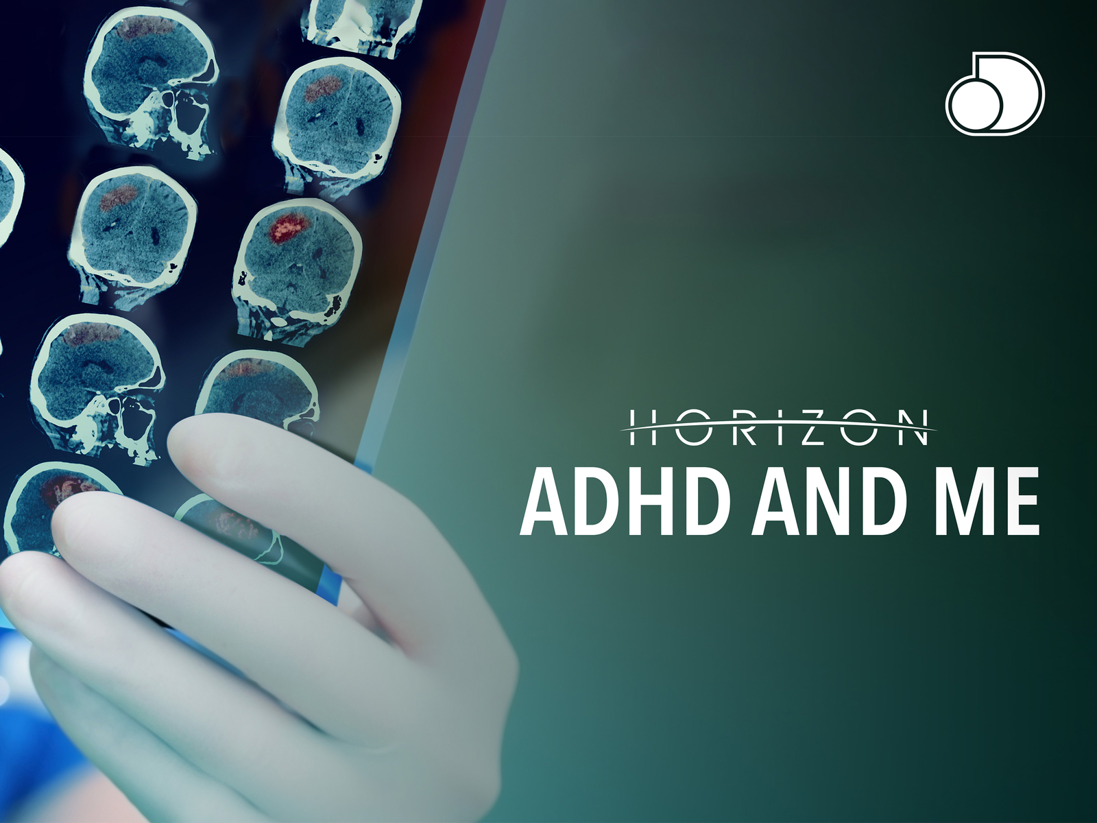 ADHD and Me, film