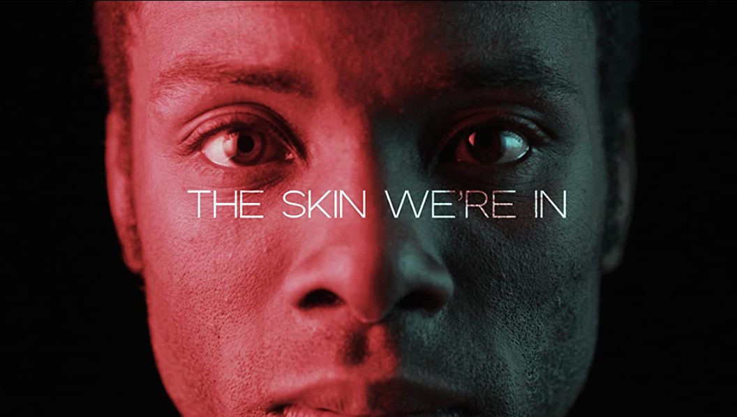 The Skin We're In film